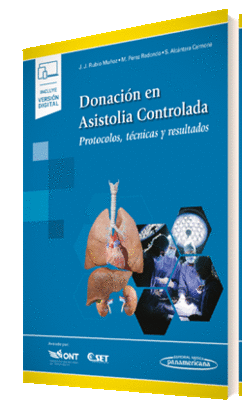 DONACION EN ASISTOLIA CONTROLADA