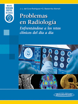 PROBLEMAS EN RADIOLOGIA