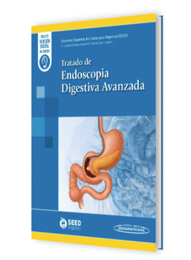 TRATADO DE ENDOSCOPIA DIGESTIVA AVANZADA