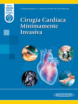 CIRUGIA CARDIACA MINIMAMENTE INVASIVA