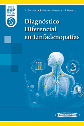 DIAGNOSTICO DIFERENCIAL EN LINFADENOPATIAS