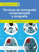 TECNICAS DE TOMOGRAFIA COMPUTERIZADA Y ECOGRAFIA