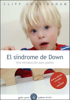 SINDROME DE DOWN EL