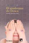 SÍNDROME DE DOWN EL