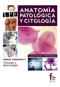 ANATOMÍA PATOLÓGICA Y CITOLOGÍA UNIDAD FORMATIVA 4