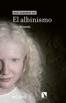 ALBINISMO EL