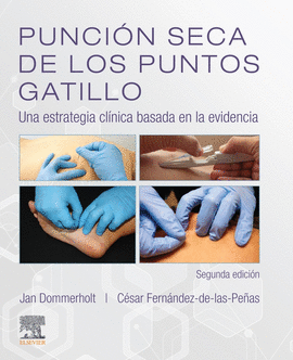 PUNCIÓN SECA DE LOS PUNTOS GATILLO (2ª ED.)