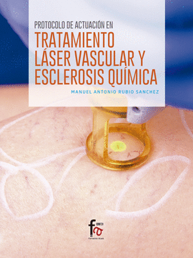 PROTOCOLO DE ACTUACION EN TRATAMIENTO LASER VASCULAR