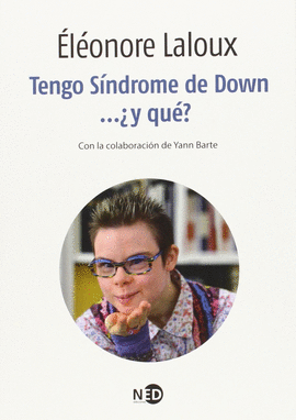 TENGO SINDROME DE DOWN Y QUE