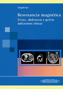 RESONANCIA MAGNETICA TORAX ABDOMEN Y PELVIS